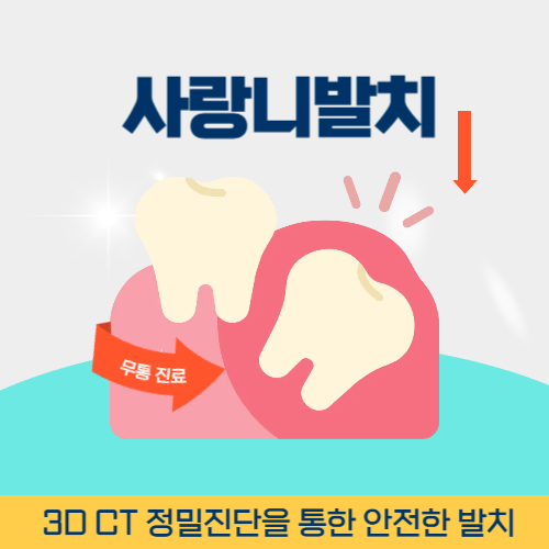 통영치과 통영시 치과 사랑니 발치